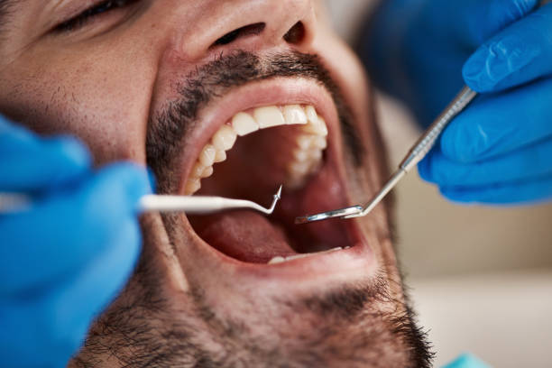 Best Tooth Pain Emergency Relief  in Red Chute, LA